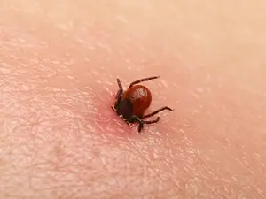 Tick Kills MA Man - Here's What His Family Wants You To Know