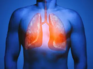 Is Your Air Killing You? The Hidden Cancer Risk You Can't Escape