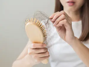 Is Your Hair Thinning? These 10 Habits Could Be To Blame!