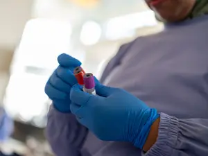 Michigan Phlebotomist Allegedly Dismembers Her Boyfriend